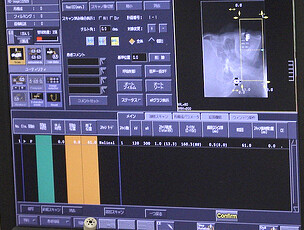 CT(マルチスキャン レントゲン撮影)モニターを見てインプラントの検査